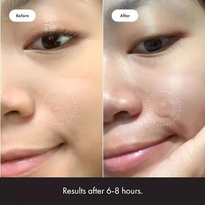 Hero Cosmetics Mighty Patch Original Acne Pimple Patches